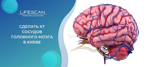 Компьютерная томография сосудов головного мозга