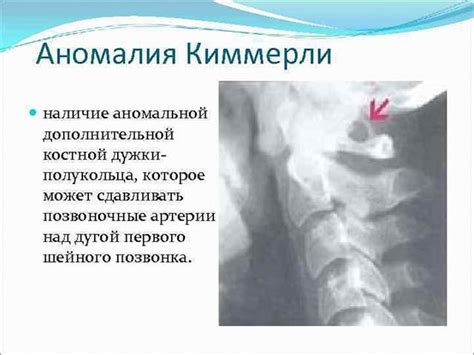 Консультация специалиста и возможные методы исправления аномалии