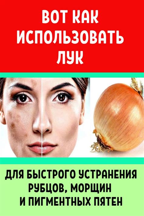 Косметические процедуры для устранения рубцов