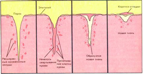 Кровотечение и ссадины