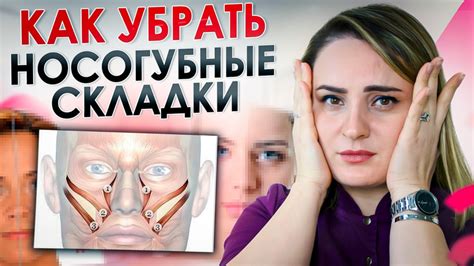 Кушинговое лицо: как избавиться эффективно