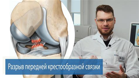 Лечение и профилактика тендиноза крестообразных связок