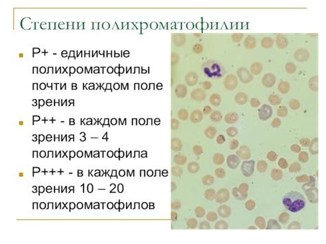 Лечение полихроматофилии