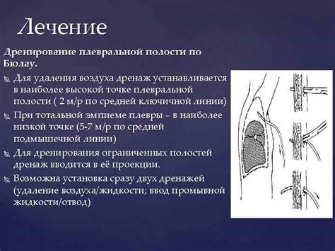 Лечение разрыва плевры