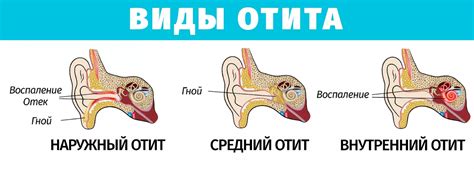 Лечение теплых ушей