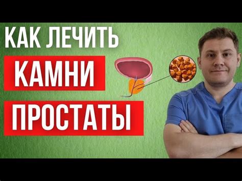 Лечение узла в предстательной железе