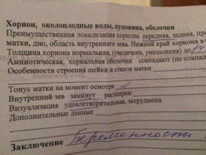 Локализация хориона по задней стенке: что это такое?