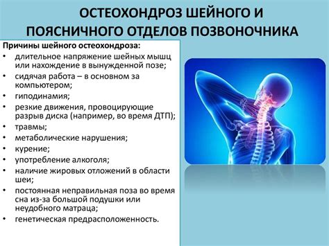 Люмбалгия шейного отдела позвоночника