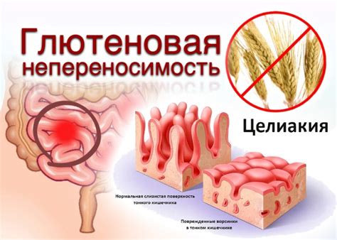 Маточная опухоль: основные симптомы и способы диагностики