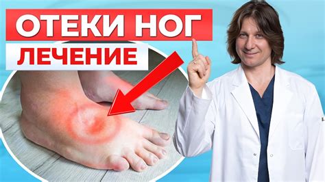 Медицинские методы лечения отека ноги