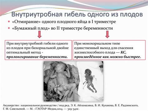 Медицинские условия, влияющие на гибель плода