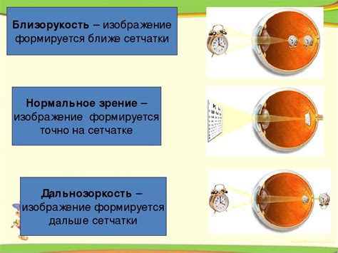 Методы диагностики гиперметропии