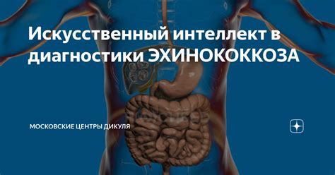 Методы диагностики эхинококкоза