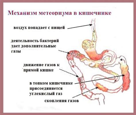 Методы для отпускания газов в желудке и кишечнике