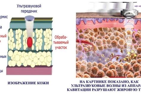 Методы избавления от жировых отложений в домашних условиях