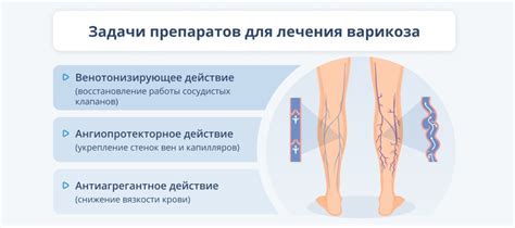 Методы избавления от покалывания в венах на ноге