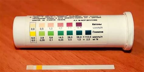 Методы измерения уровня кетонов в моче