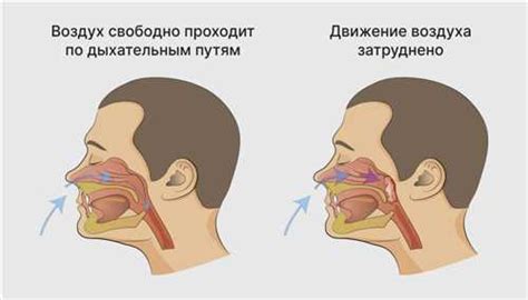 Методы лечения гипертрофии трубных валиков у детей