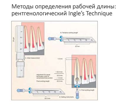 Методы определения разности длины ног