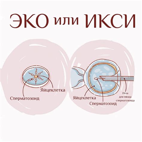 Методы проведения ЭКО процедуры