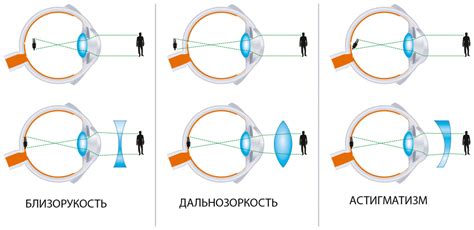 Метод "проверка на дистанции" для определения дальнозоркости