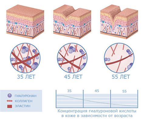 Метод 5: Консультация с врачом-дерматологом и применение рекомендованных препаратов