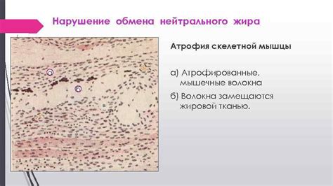 Механизмы образования жира