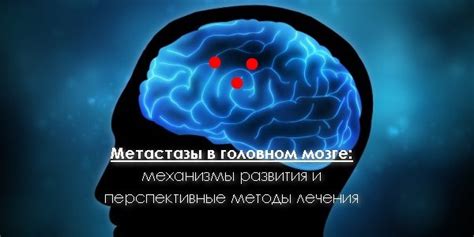 Механизмы хранения информации в мозге распределителя