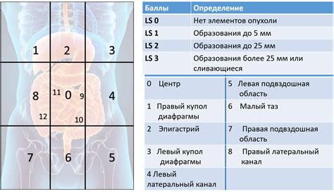 Механизм развития канцероматоза брюшины