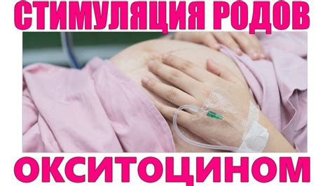 Механическая стимуляция родов