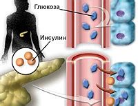 Моди диабет - особенности, симптомы и лечение