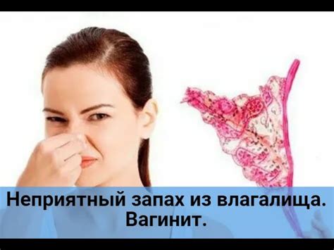 Можно ли устранить неприятный запах выделений при гонорее?