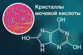 Мочевая кислота - суставные проблемы