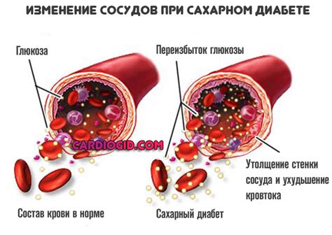 Мочевина в крови: причины и последствия