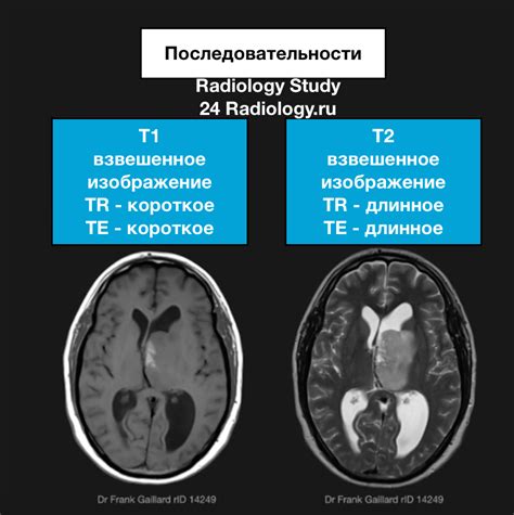 М эхо: концепция и сущность