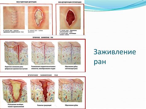 Наличие инфекции и заживление ран