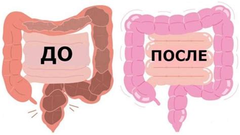 Натуральные способы очищения языка