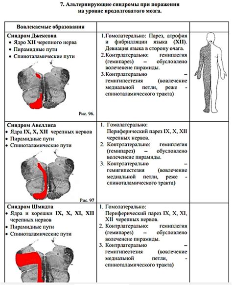 Нахождение ПКП на уровне карты