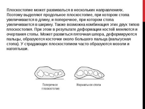 Начертите основные очертания косточки