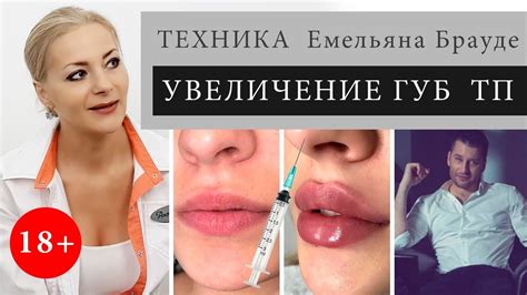 Неверная техника увеличения губ