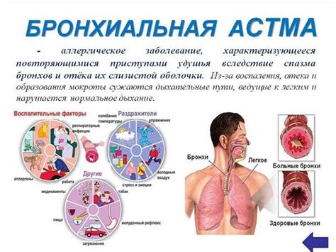 Неврологические причины частого дыхания