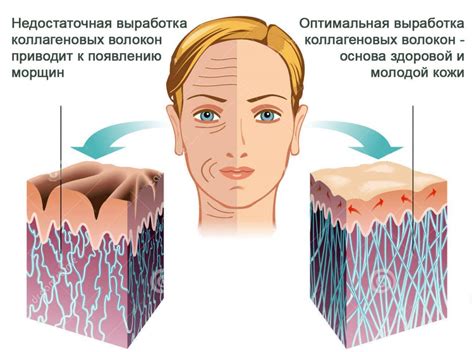 Недостаток эластина и коллагена