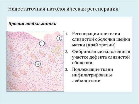 Недостаточная регенерация организма