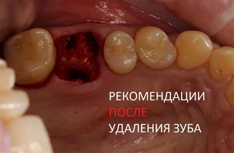 Необходимость удаления корочки после операции