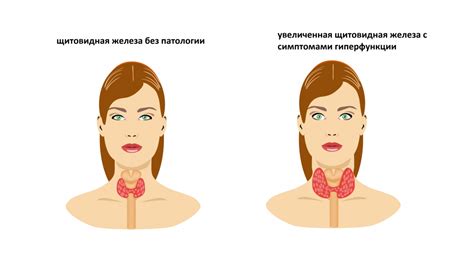 Норма и отклонения уровня ТТГ у женщин