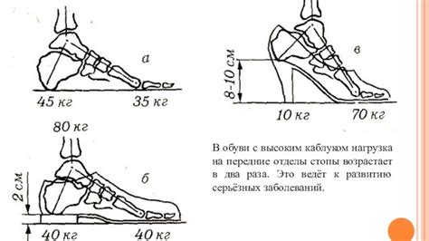 Ношение удобной обуви с подошвами поддерживающей дуги стопы