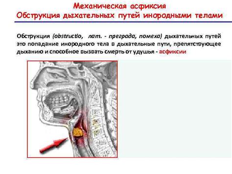 Обструкция дыхательных путей у крысы