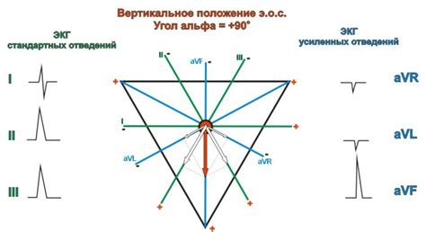 Ограничения и проблемы ЭКГ электрозабора влево