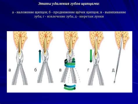 Операция удаления непосредственно ветки