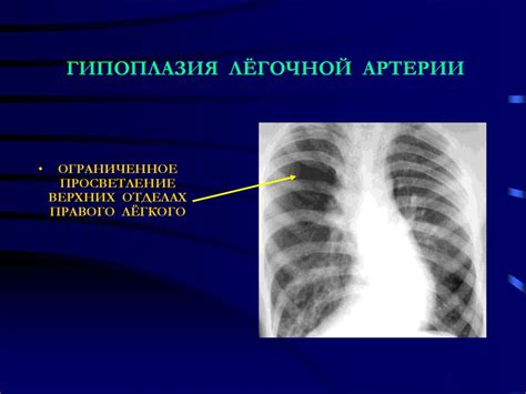 Описание симптомов гепатоспленомегалии